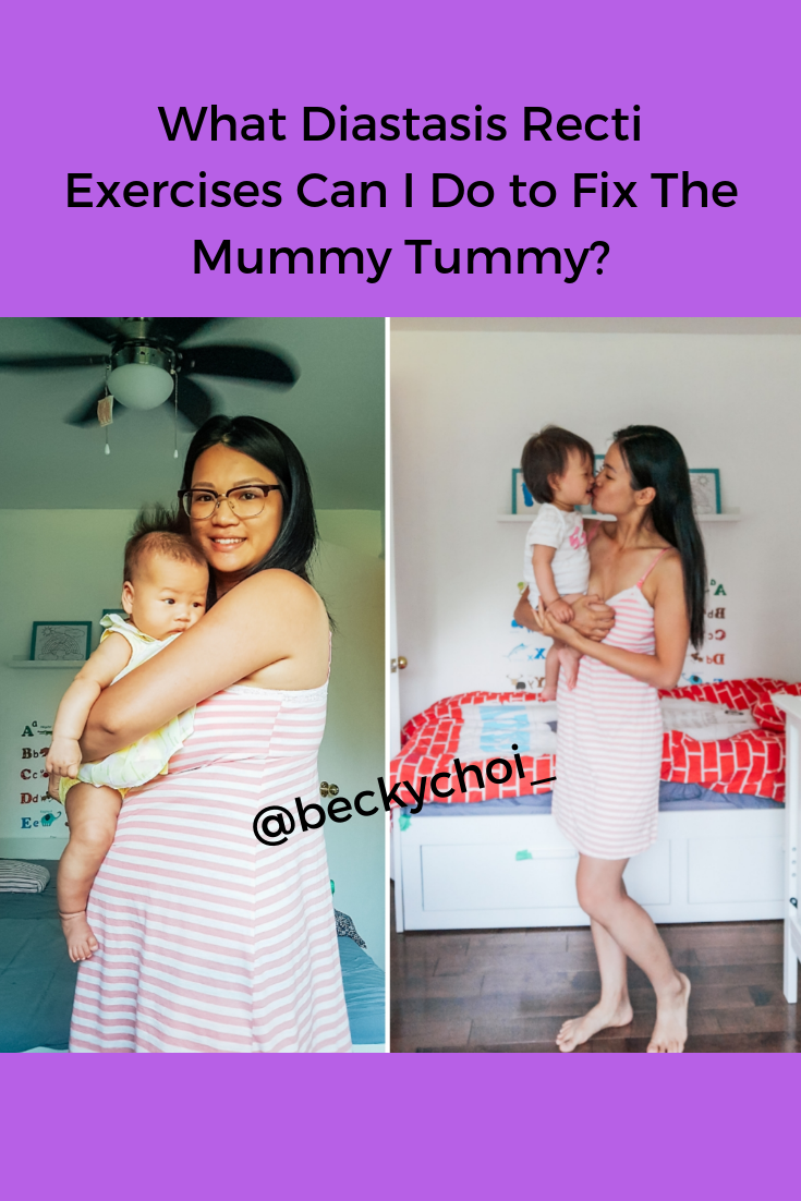 What Diastasis Recti Exercises Can I Do To Fix The Mummy Tummy