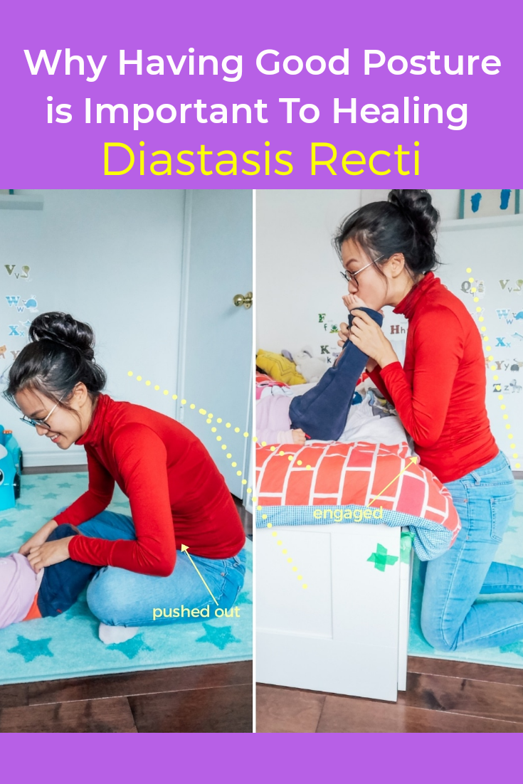 Diastasis Recti - Becky on Instagram: “  Transformation body, Diastasis  recti, Diastasis